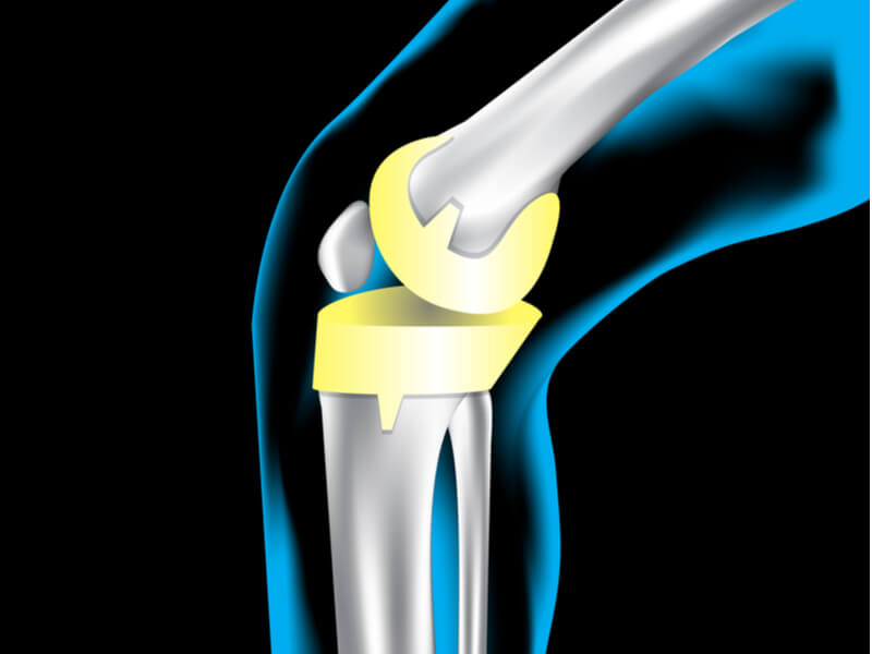 リスクを軽減する